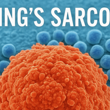 Ewing’s Sarcoma Cancer